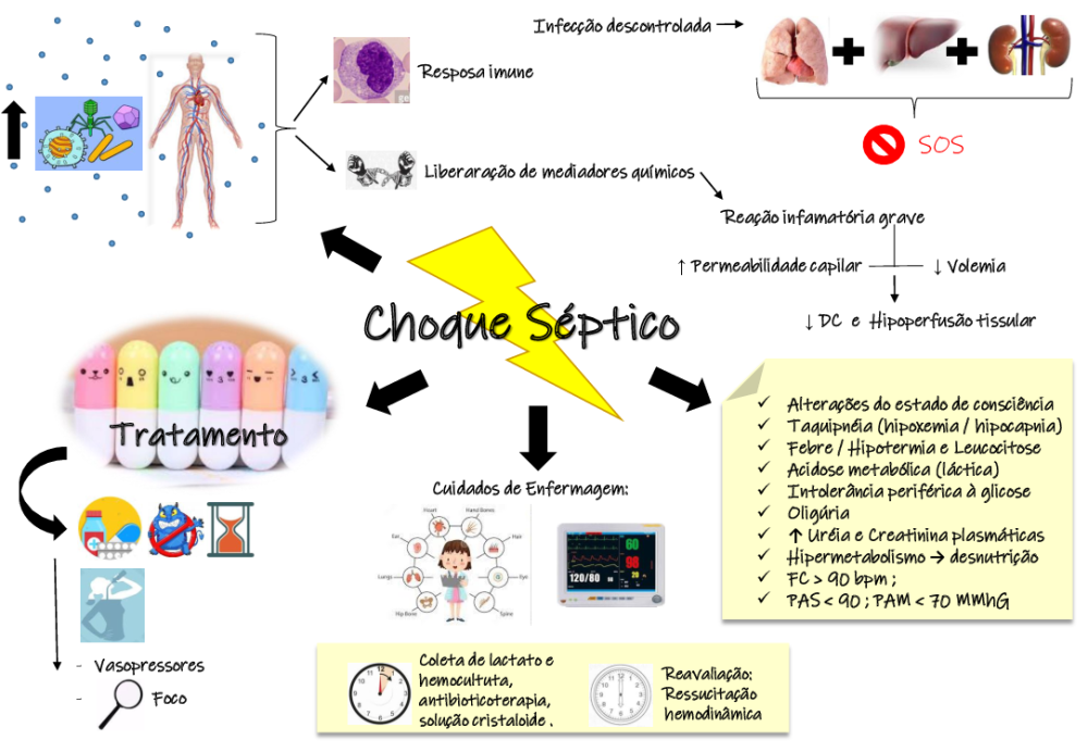 Mapa mental - Choque Séptico Final - Baixar pdf de 