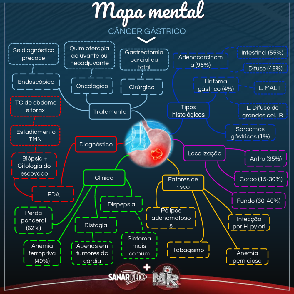 Mapa Mental Câncer de Estômago - Baixar pdf de 