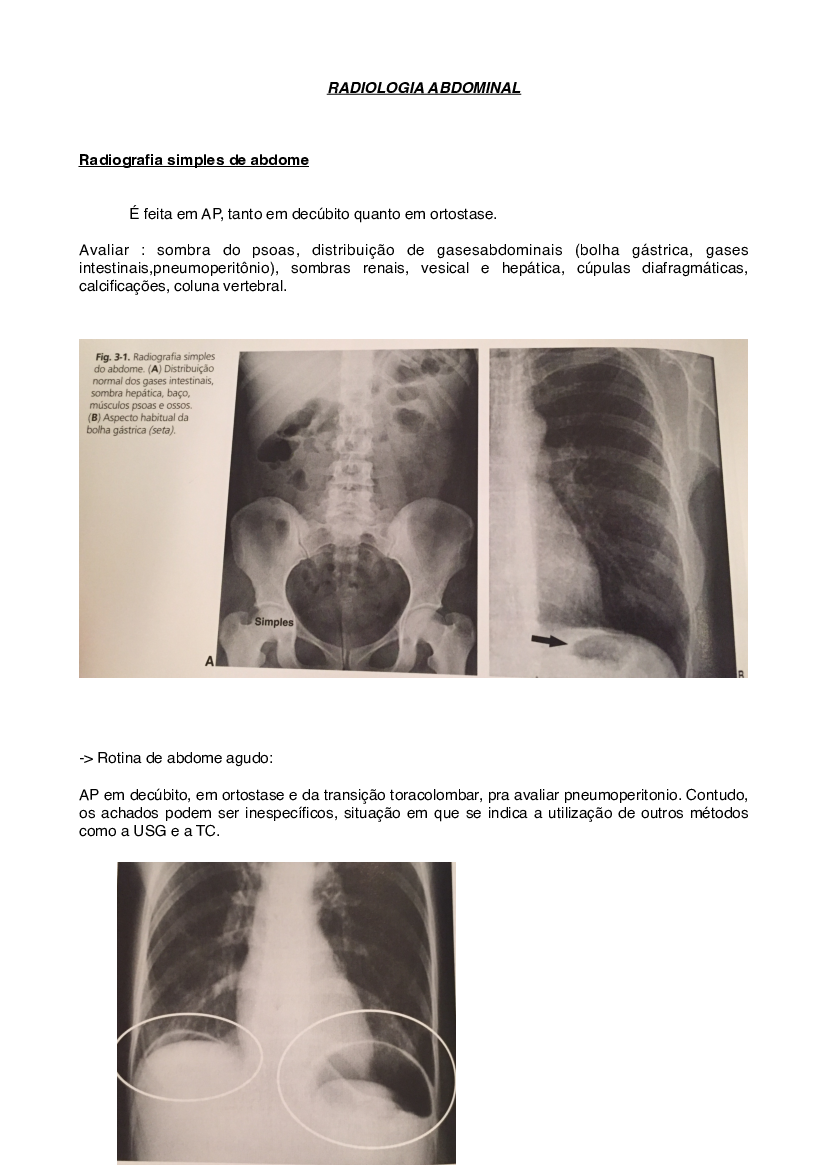 Aula 2 - radiologia abdominal - Baixar pdf de
